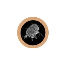 GIANTMICROBES SCABBIA Mange (Sarcoptes Scabiei)