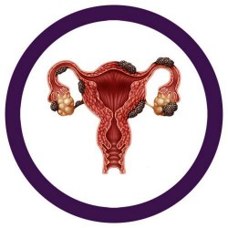 Giantmicrobes Endometriosis | Agile Italia
