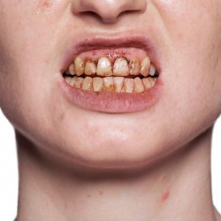 Smalto per Denti Kryolan (K1220) | Agile Italia