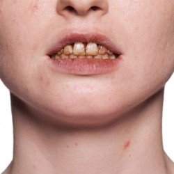 Smalto per Denti Kryolan (K1220) | Agile Italia
