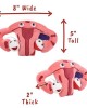 GIANTMICROBES ENDOMETRIOSIS