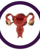 GIANTMICROBES ENDOMETRIOSIS