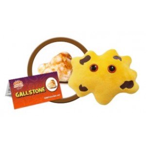 GIANTMICROBES CALCOLO BILIARE Gallstones
