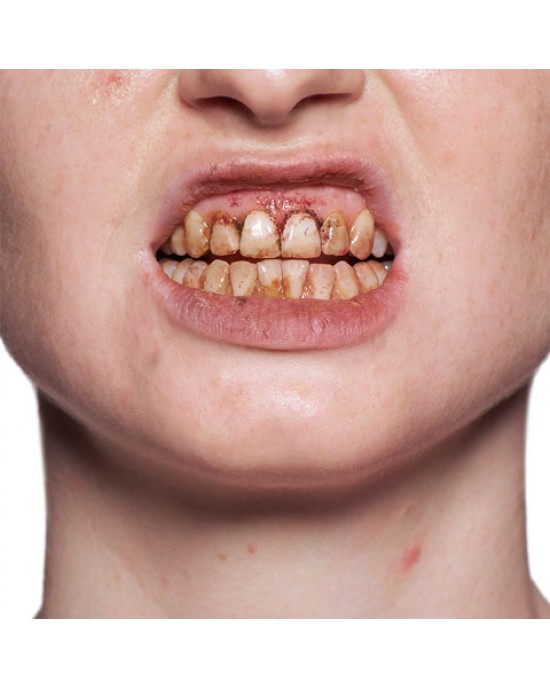 SMALTO PER DENTI KRYOLAN