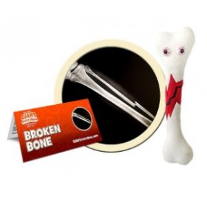 GIANTMICROBES PELUCHE FRATTURA - Broken Bone