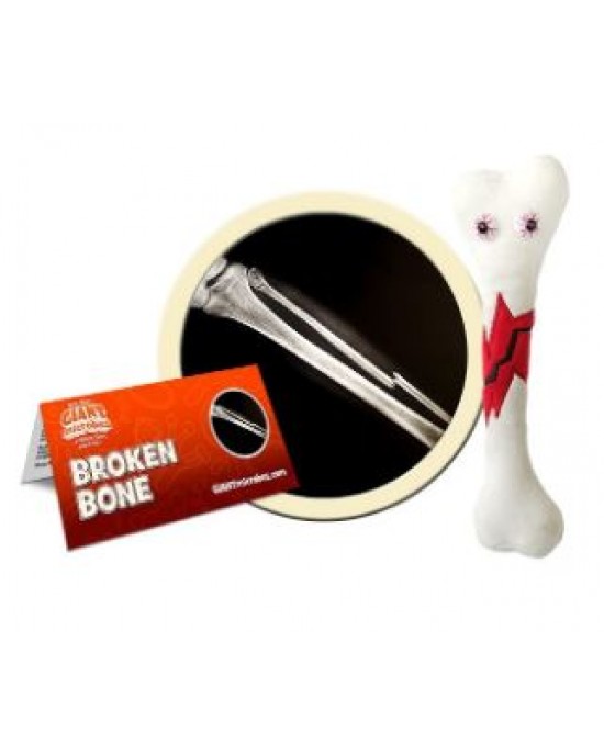 GIANTMICROBES PELUCHE FRATTURA - Broken Bone